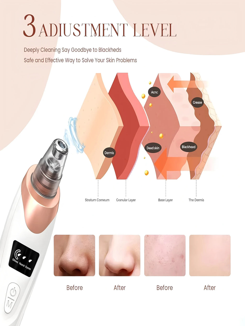 Facial Suction Tool , USB Rechargeable Pore Care Instrument for Deep Cleansing and Skin Exfoliation. Pore