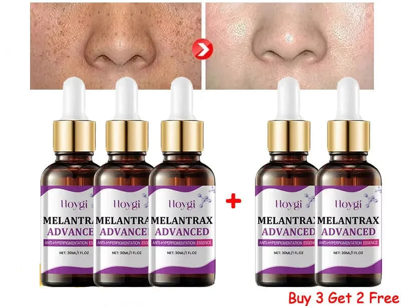 Hoygi Niacinamide Facial Serum Vitamin B3 Wrinkles Pigment Dark Spot Removal Correcting Glow Serum Face Whitening Moisturizer
