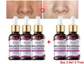 Hoygi Niacinamide Facial Serum Vitamin B3 Wrinkles Pigment Dark Spot Removal Correcting Glow Serum Face Whitening Moisturizer