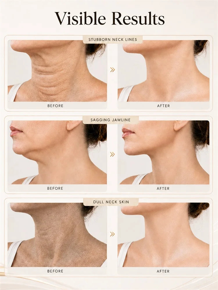 Neck Face Lifting Device, Lifting Device Face for Double Chin & Neck Firming, EMS Microcurrent, 7 Color LED Therapy Beauty Tools