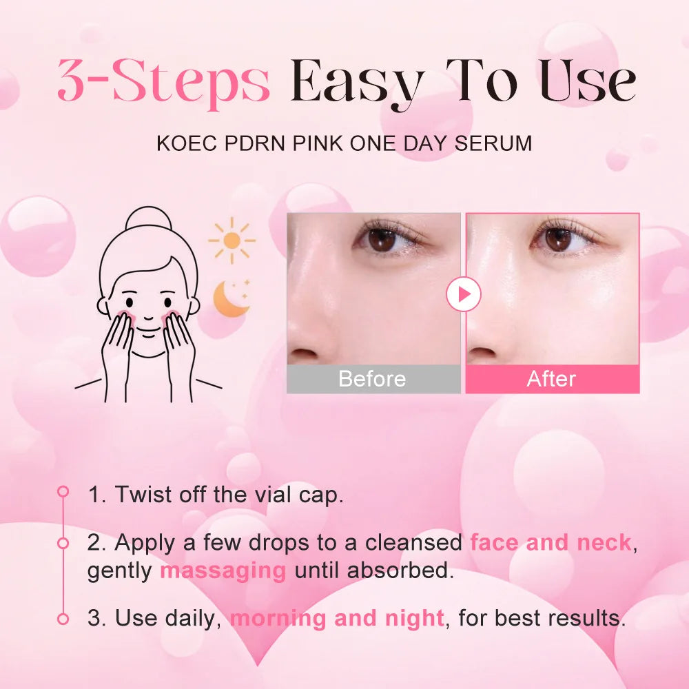 10Vials/Box PDRN Pink One Day Serum Firming Hydrating Ampoule Oil Control Pore Refining Smoothing Skin Rejuvenation Essence