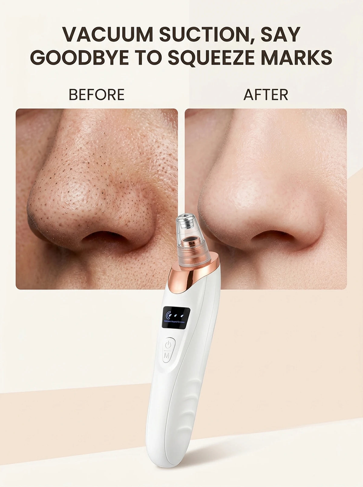 Facial Suction Tool , USB Rechargeable Pore Care Instrument for Deep Cleansing and Skin Exfoliation. Pore