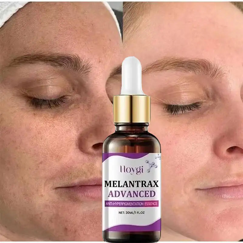 Hoygi Niacinamide Facial Serum Vitamin B3 Wrinkles Pigment Dark Spot Removal Correcting Glow Serum Face Whitening Moisturizer