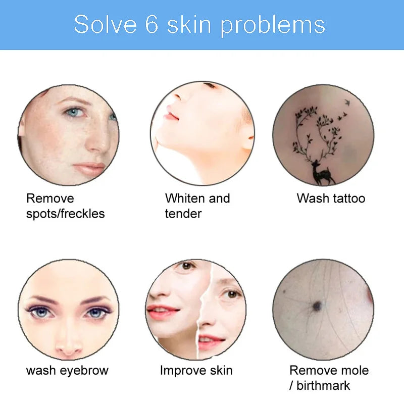 Picosecond Laser Handle Probe E-light OPT Hair Removal, Eyebrow Washing, Tattoo Washing Beauty Instrument Accessories