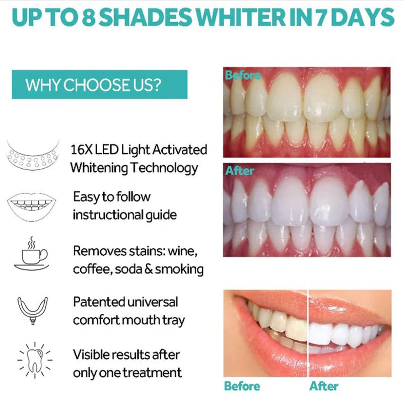 Teeth Blue Light Whitening Instrument Universal Interface Portable Rechargeable Blue Light Oral Care Lamp Tool